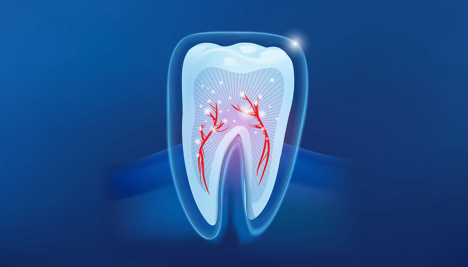 Endodoncia en Clínica Dali Dent Parla