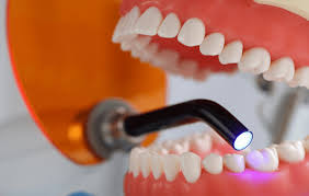 Periodoncia en Clínica Dali Dent Parla