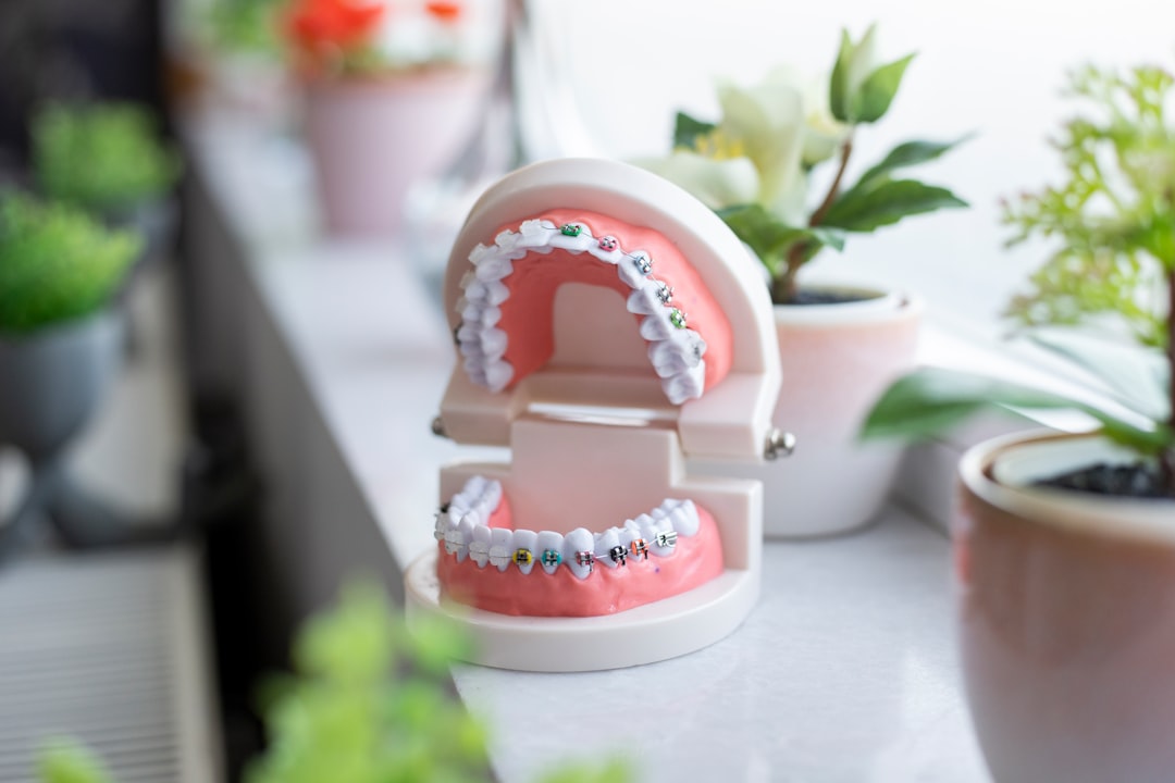 Ortodoncia invisible o brackets: diferencias para elegir bien